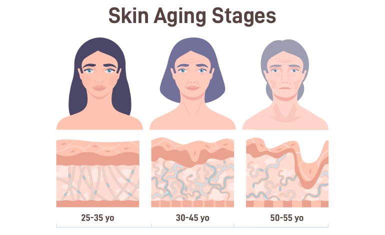 skin aging