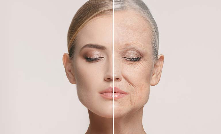 skin aging due to collagen loss