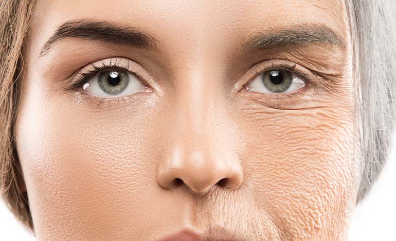 collagen and face wrinkles