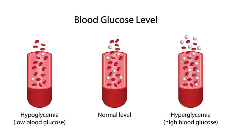 blood glucose level