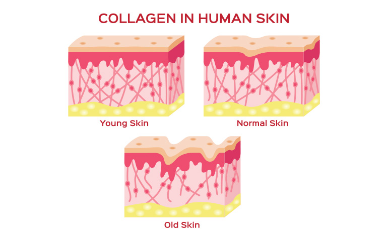 collagen and aging