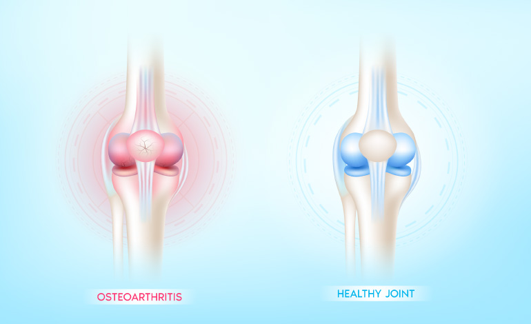 joint health