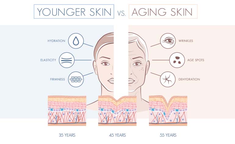 collagen face lift