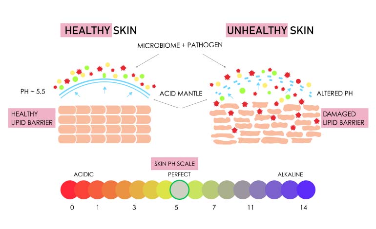 healthy vs. unhealthy skin