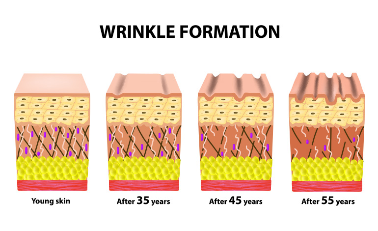 wrinkle formation